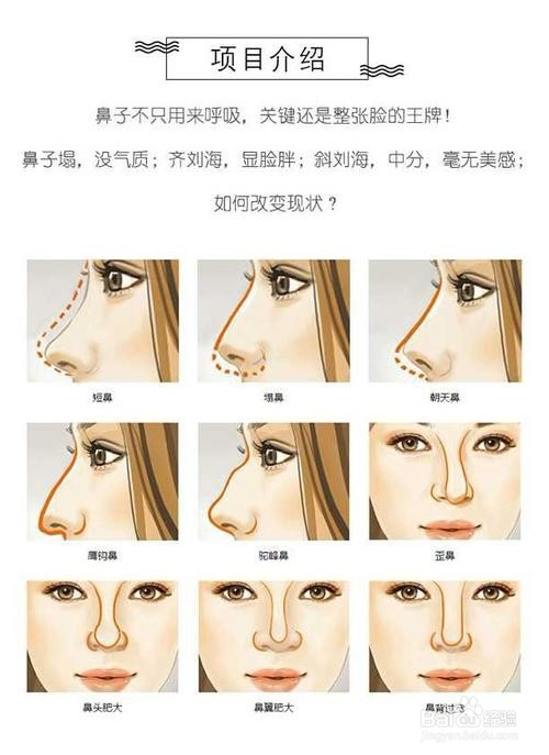 各种鼻子的形状示例图.jpg
